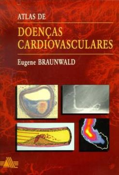 Imagem de ATLAS DE DOENCAS CARDIOVASCULARES