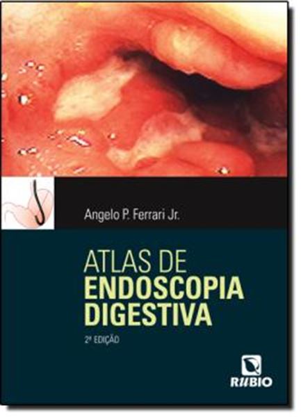 Picture of ATLAS DE ENDOSCOPIA DIGESTIVA 2 EDICAO