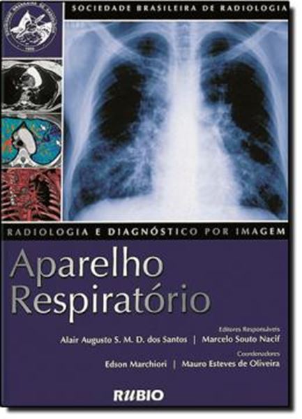 Picture of RADIOLOGIA E DIAGNOSTICO POR IMAGEM   APARELHO RESPIRATORIO