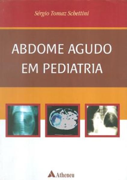 Picture of ABDOME AGUDO EM PEDIATRIA