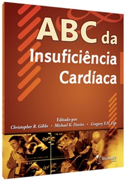 Picture of ABC DA INSUFICIENCIA CARDIACA