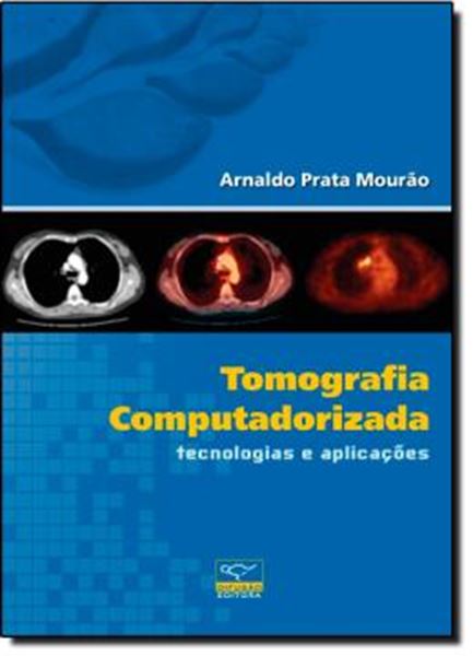 Picture of TOMOGRAFIA COMPUTADORIZADA - TECNOLOGIAS E APLICACOES