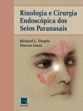 Imagem de RINOLOGIA  E CIRURGIA ENDOSCOPICA DOS SEIOS PARANASAIS