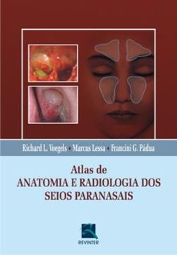 Imagem de ATLAS DE ANATOMIA  E RADIOLOGIA DOS SEIOS PARANASAIS