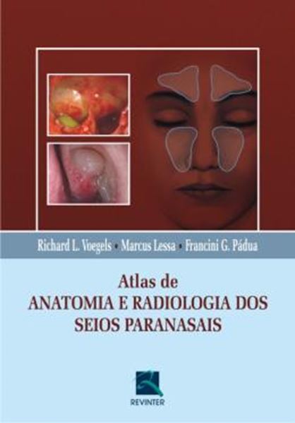 Picture of ATLAS DE ANATOMIA  E RADIOLOGIA DOS SEIOS PARANASAIS