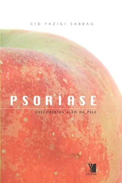Picture of PSORIASE - DESCOBERTAS ALEM DA PELE