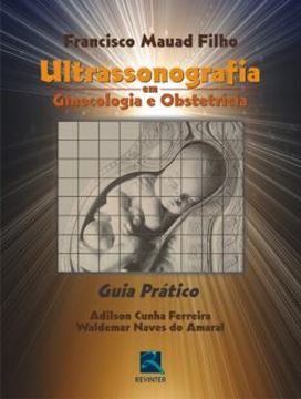 Imagem de ULTRASSONOGRAFIA EM GINECOLOGIA E OBSTETRICIA - GUIA PRATICO