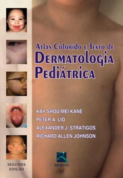 Picture of ATLAS COLORIDO E TEXTO DE DERMATOLOGIA PEDIATRICA - 2ª ED