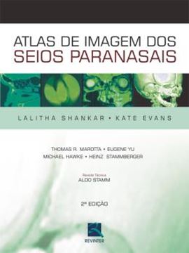 Imagem de ATLAS DE IMAGEM DOS SEIOS PARANASAIS - 2ª ED