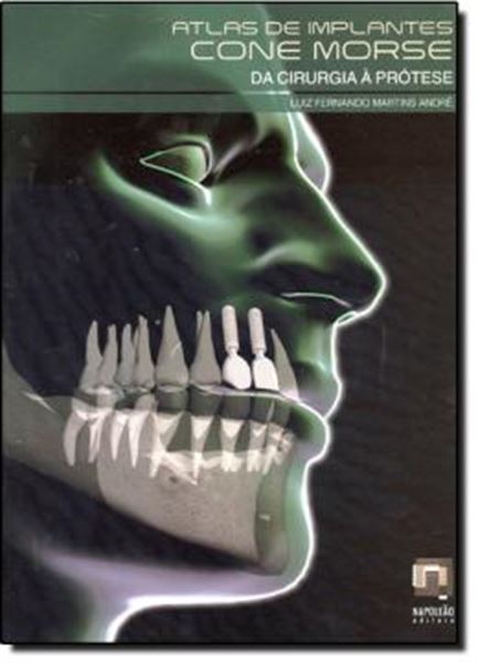 Picture of ATLAS DE IMPLANTES CONE MORSE - DA CIRURGIA A PROTESE