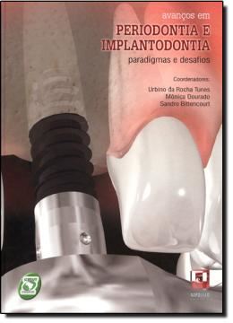 Imagem de AVANCOS EM PERIODONTIA E IMPLANTODONTIA - PARADIGMAS E DESAFIOS