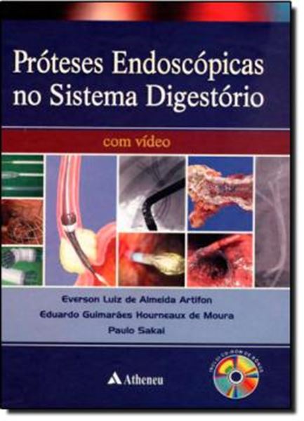 Picture of PROTESES ENDOSCOPICAS DO SISTEMA DIGESTORIO COM VIDEO
