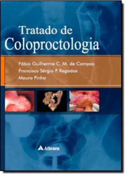 Picture of TRATADO DE COLOPROCTOLOGIA 