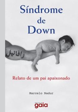 Imagem de SINDROME DE DOWN  RELATO DE UM PAI APAIXONADO             