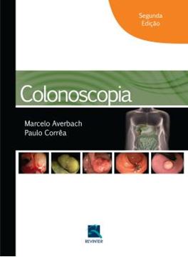 Imagem de COLONOSCOPIA - 2ª ED