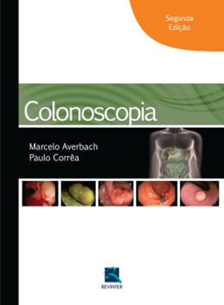 Picture of COLONOSCOPIA - 2ª ED