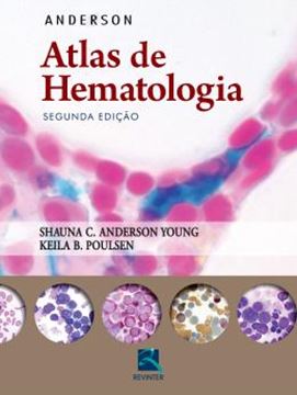 Imagem de ANDERSON - ATLAS DE HEMATOLOGIA - 2ª ED