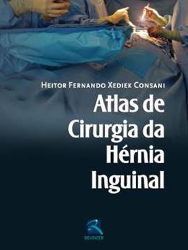 Imagem de ATLAS DE CIRURGIA DA HERNIA INGUINAL