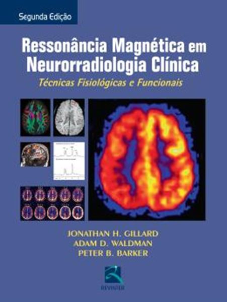 Picture of RESSONANCIA MAGNETICA EM NEURORRADIOLOGIA CLINICA - 2ª ED