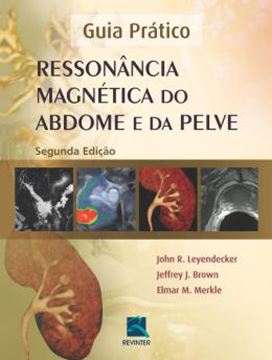 Imagem de RESSONANCIA MAGNETICA DO ABDOME E DA PELVE - 2ª ED