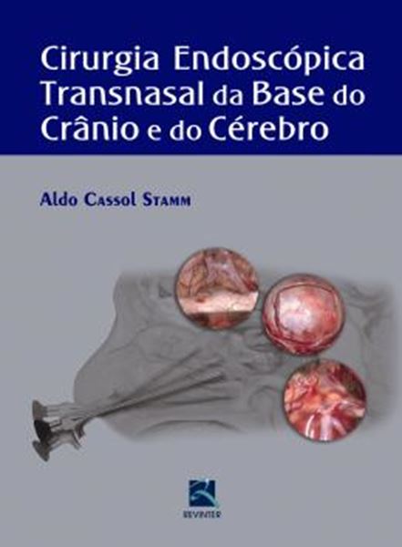 Picture of CIRURGIA ENDOSCOPICA TRANSNASAL DA BASE DO CRANIO E DO CEREBRO