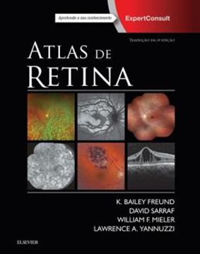 Imagem de ATLAS DE RETINA - 2ª ED