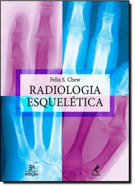 Picture of RADIOLOGIA ESQUELETICA - 3ºED