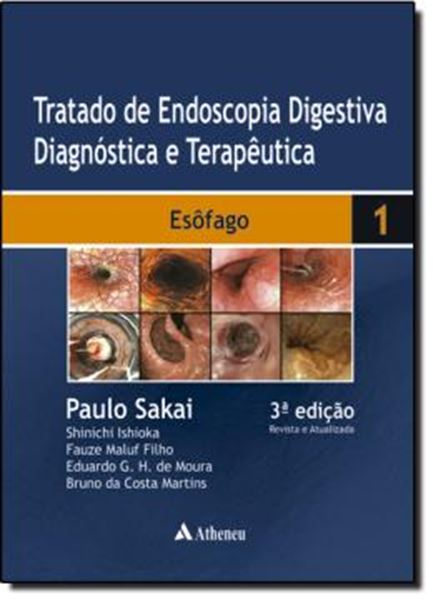 Picture of TRATADO DE ENDOSCOPIA DIGESTIVA DIAGNOSTICA E TERAPEUTICA - ESOFAGO - 3º ED
