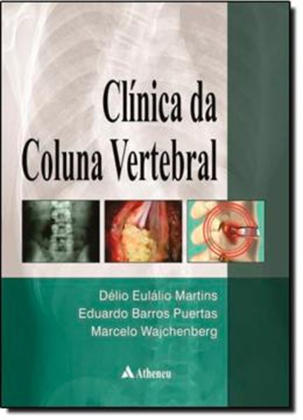 Picture of CLINICA DA COLUNA VERTEBRAL