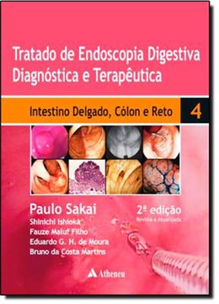 Picture of TRATADO DE ENDOSCOPIA DIGESTIVA- INTESTINO DELGADO, COLON E RETO - 2º ED