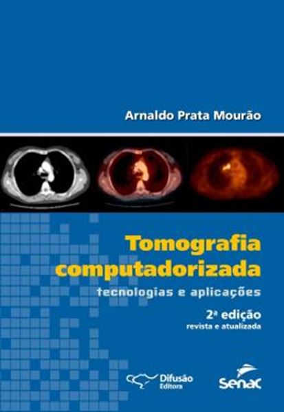 Picture of TOMOGRAFIA COMPUTADORIZADA TECNOLOGIAS E APLICACOES - 2º ED