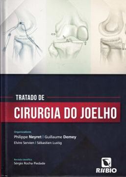 Imagem de TRATADO DE CIRURGIA DO JOELHO