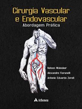 Imagem de CIRURGIA VASCULAR E ENDOVASCULAR - ABORDAGEM PRATICA