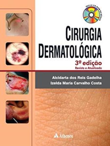 Picture of CIRURGIA DERMATOLOGICA - 3ª ED