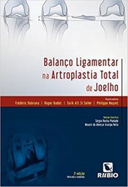 Picture of BALANCO LIGAMENTAR NA ARTROPLASTIA TOTAL DE JOELHO - 2ª ED