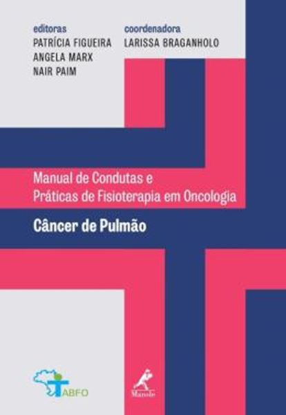 Picture of CANCER DE PULMAO