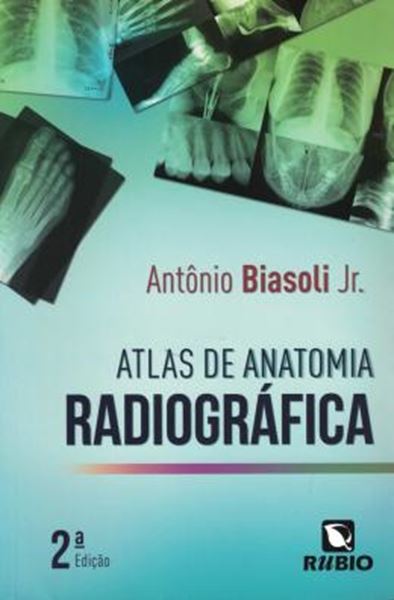 Picture of ATLAS DE ANATOMIA RADIOGRAFICA - 2ª ED