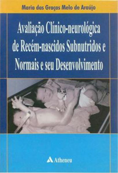 Picture of AVALIACAO CLINICO-NEUROLOGICA DE RECEM-NASCIDOS SUBNUTRIDOS NORMAIS E SEU DESENVOLVIMENTO