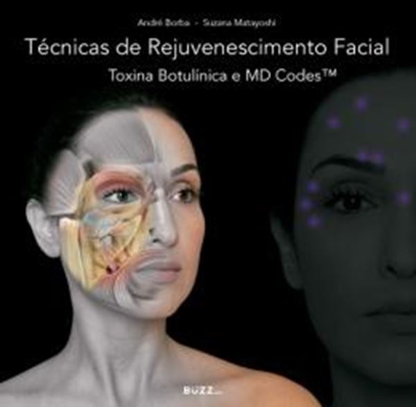 Picture of TECNICAS DE REJUVENESCIMENTO FACIAL - TOXINA BOTULINICA E MD CODES