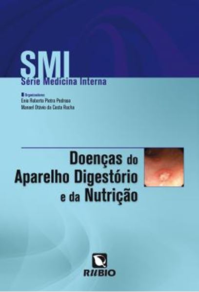 Picture of SMI - SERIE MEDICINA INTERNA - DOENCAS DO SISTEMA DIGESTORIO E DA NUTRICAO