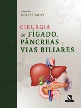 Imagem de CIRURGIA DE FIGADO, PANCREAS E VIAS BILIARES