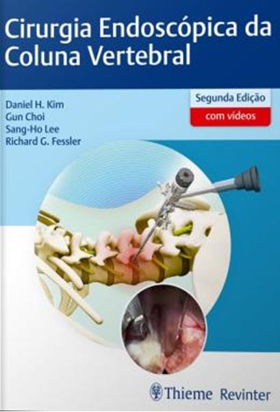 Picture of CIRURGIA ENDOSCOPICA DA COLUNA VERTEBRAL - 2ª ED
