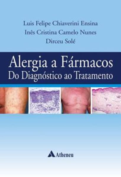 Picture of ALERGIA A FARMACOS DO DIAGNOSTICO AO TRATAMENTO
