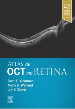 Imagem de ATLAS DE OCT EM RETINA