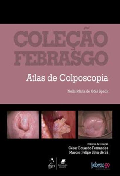 Picture of COLECAO FEBRASGO - ATLAS DE COLPOSCOPIA