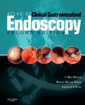 Imagem de ATLAS/GASTROINTESTINAL ENDOSCOPY WITH CD-ROM - 2ND ED