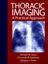 Imagem de REVIEW OF THORAIC IMAGING AND CHEST DISEASE