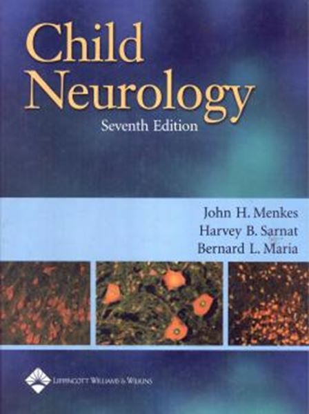 Picture of CHILD NEUROLOGY - 7TH  ED