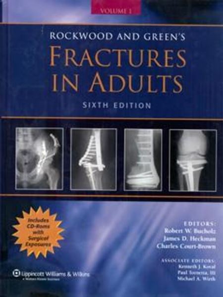 Picture of ROCKWOOD AND GREEN´S FRACTURES IN ADULTS 2 VOLS. - 6TH EDITION