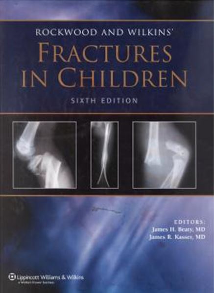 Picture of ROCKWOOD AND WILKINS - FRACTURES IN CHILDREN - 6TH ED